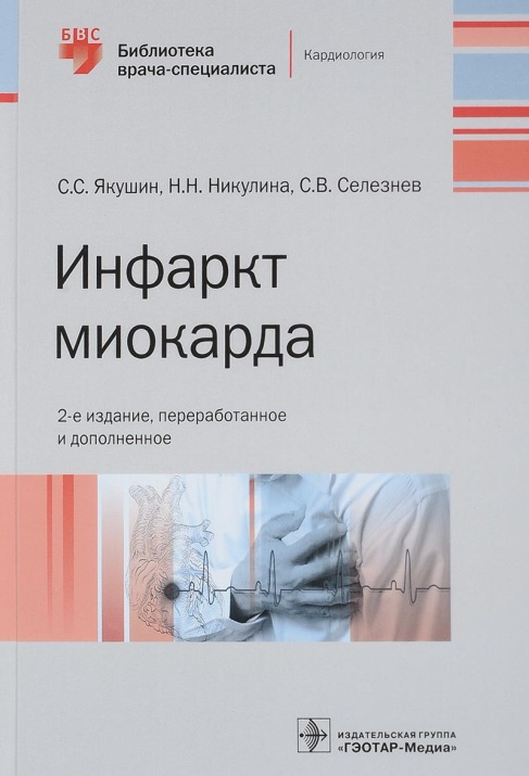 Инфаркт миокарда