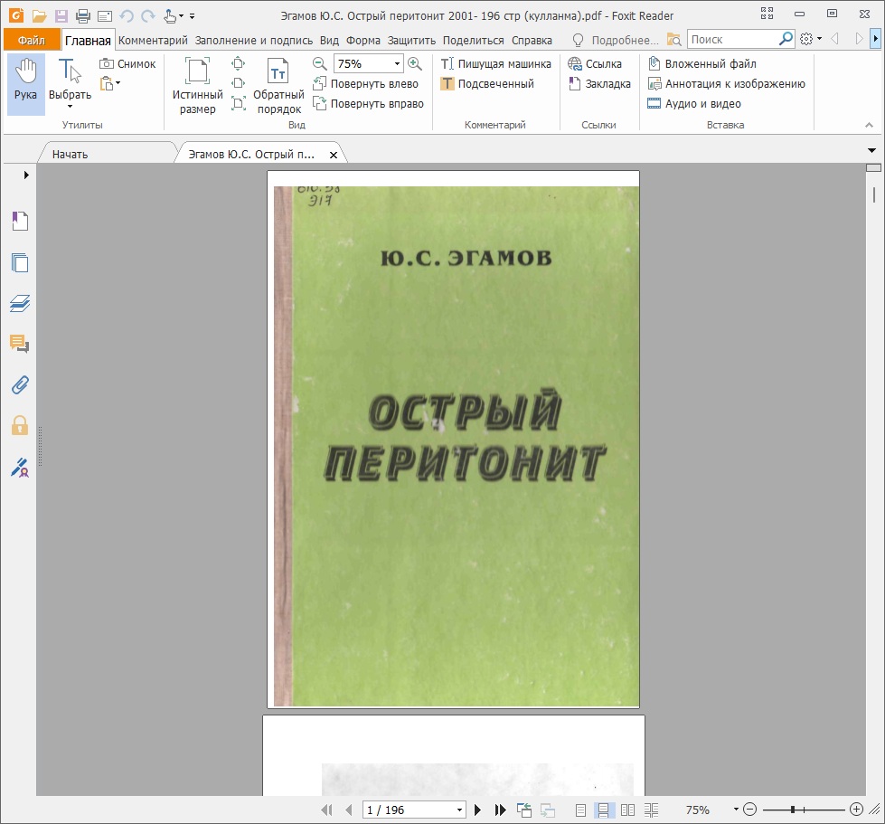 Острий перитонит