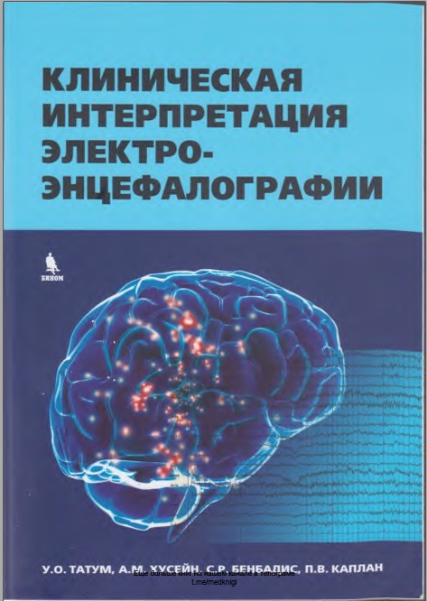 Клиническая интерпретация  электро-энфецалографии
