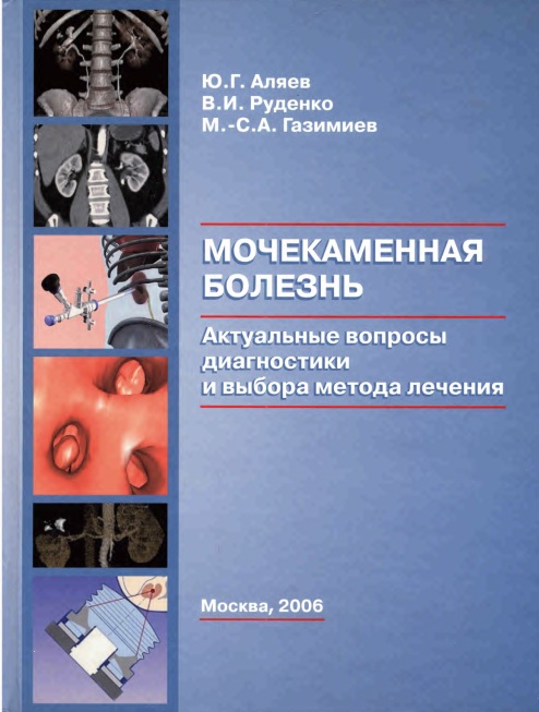 Мочекаменная болезнь. Актуальные вопросы диагностики и выбора метода лечения