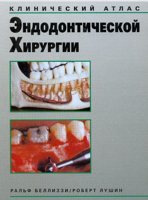 Клинический атлас эндодонтической хирургии