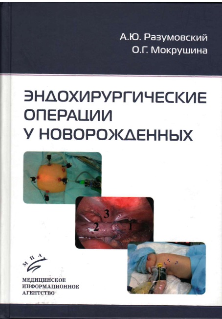 Эндохирургические операции у новорожденных