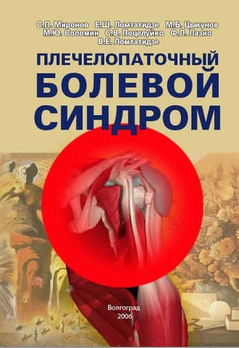 Плечелопаточный болевой синдром