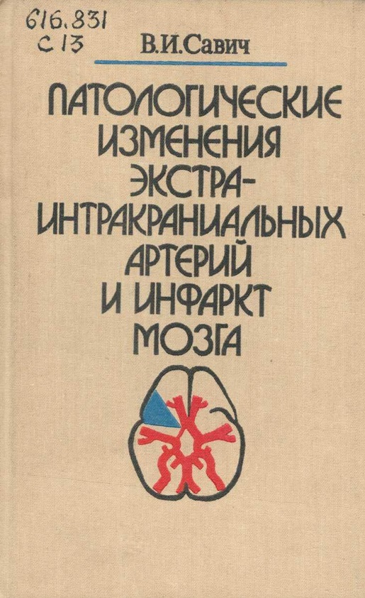 Патологические изменения экстра-интракраниальных артерий и инфаркт мозга