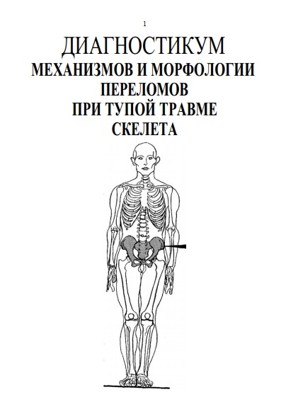 Диагностику™ механизмов и морфологии переломов при тупой травме скелета