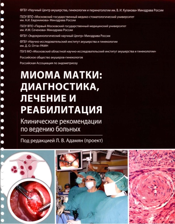 Миомама матки диагностика, лечение и реабилитация