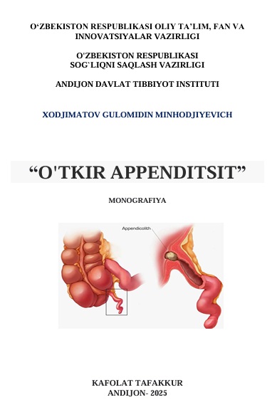 O'tkir appenditsit