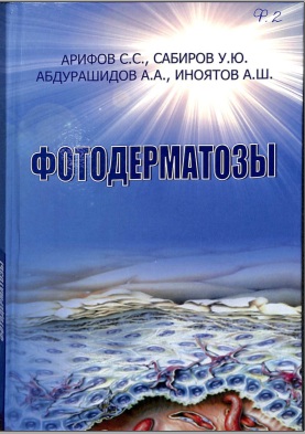 Фотодерматозы