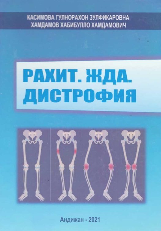 Рахит. ЖДА. Дистрофия