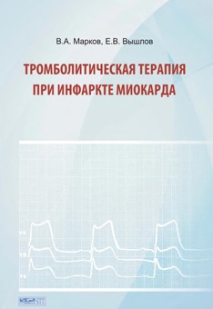 Тромболитическая терапия при М 25 инфаркте миокарда