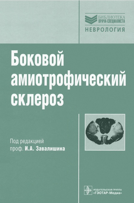 Боковой амиотрофический склероз