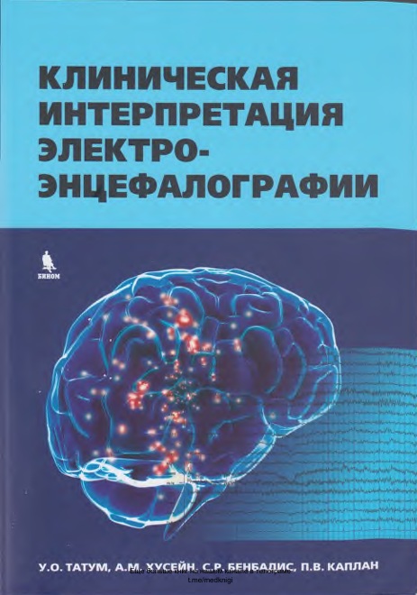 Клиническая интерпретация электро-энцефалографии