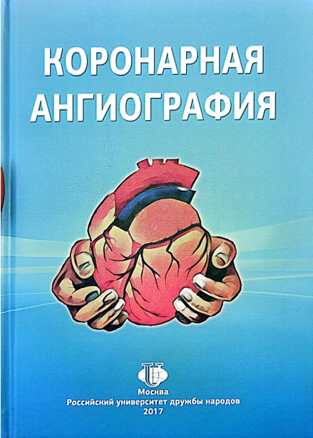 Коронарная ангиография