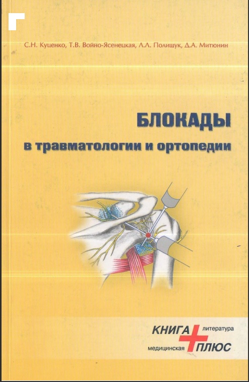 Блокады в травматологии и ортопедии