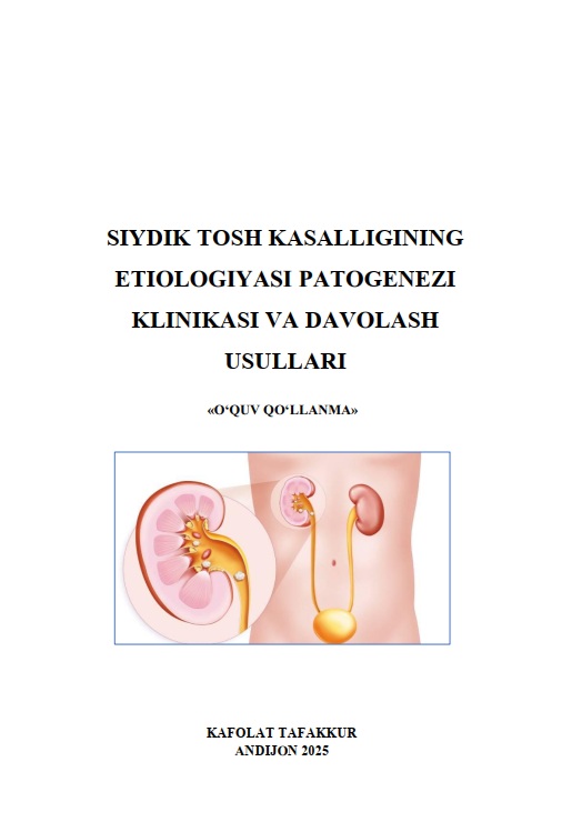 Siydik tosh kasalligining etiologiyasi patogenezi klinikasi va davolash usullari