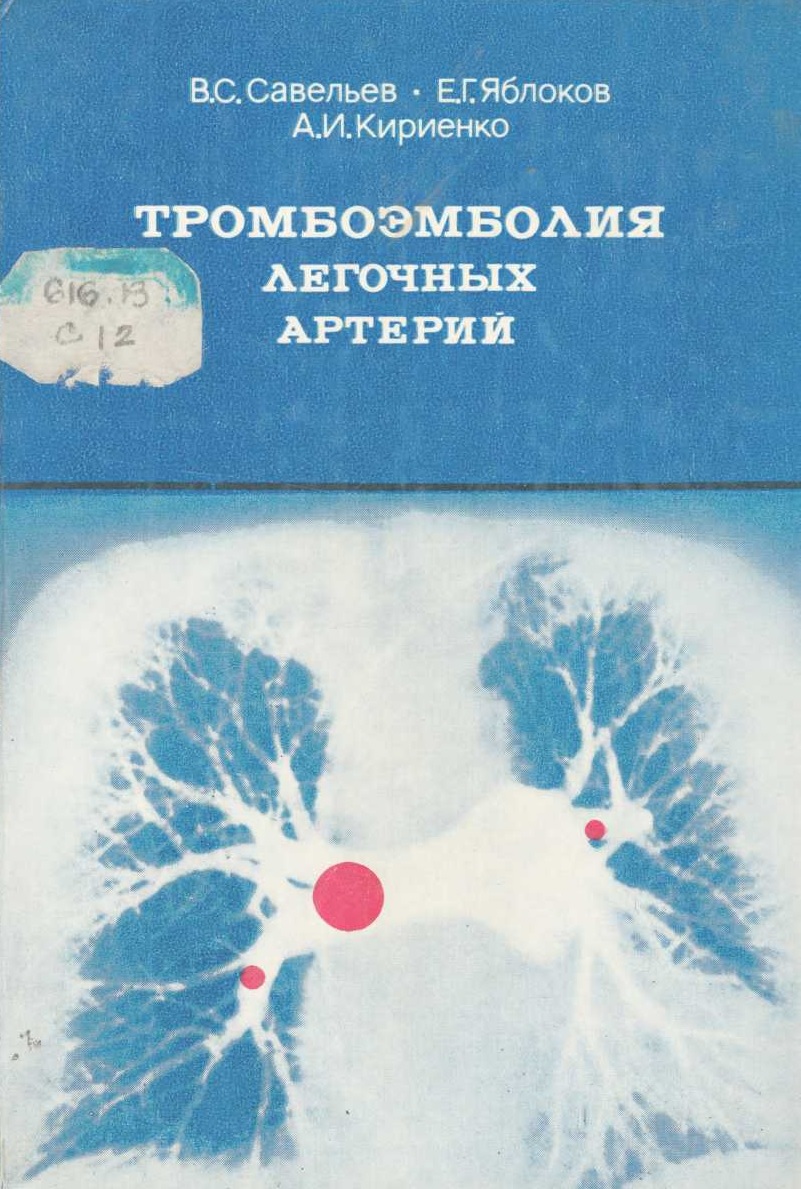 Тромбоэмболия легочных артерий. 