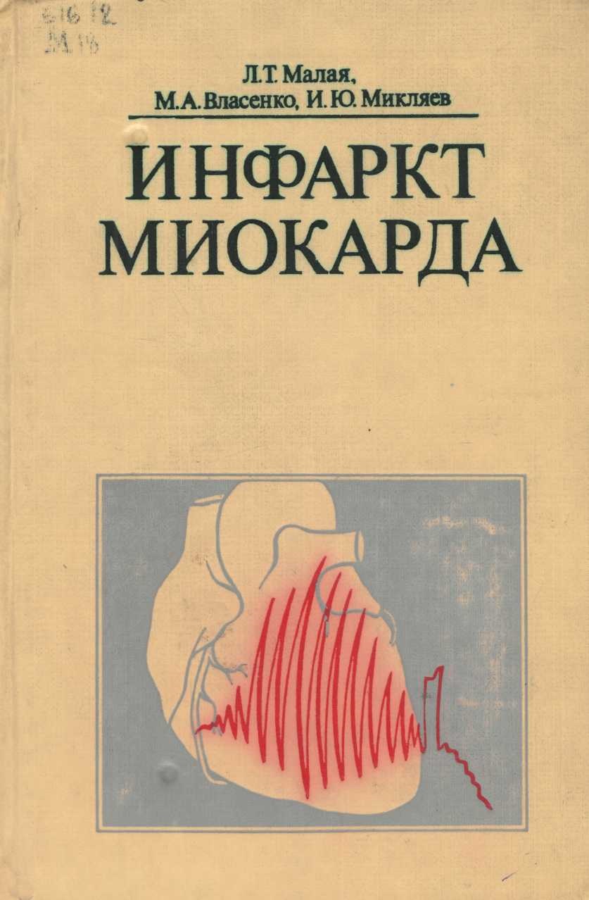 Инфаркт миокарда