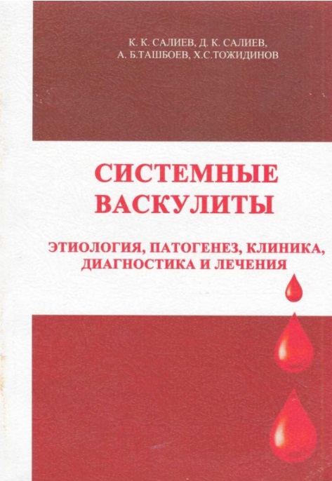 Системные васкулиты, этиология, патогенез, клиника, диагностика и лечения