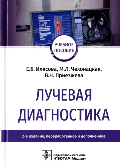 Лучевая диагностика