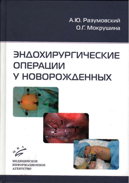 Эндохирургические операции у новорожденных