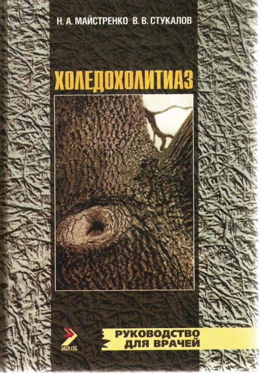 Холедохолитиаз
