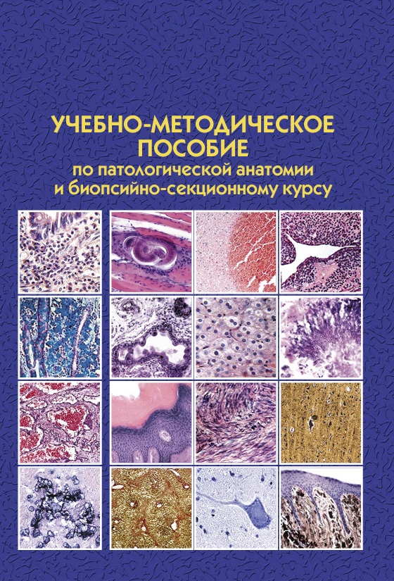 Учебно-методическое пособие по патологической анатомии  и биопсийно-секционному курсу