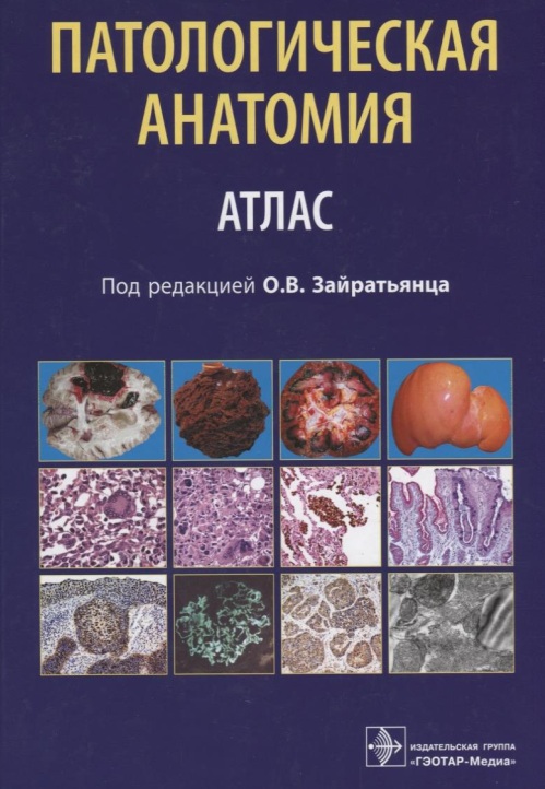 Патологическая анатомия. Атлас