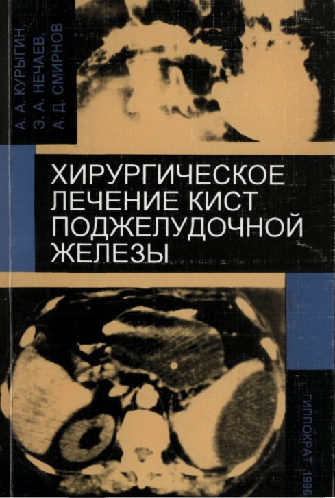 Хирургическое лечение кист поджелудочной железы