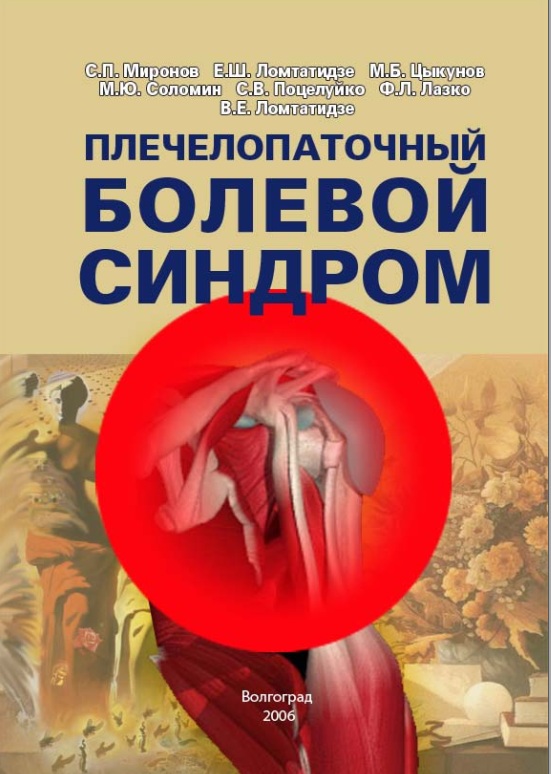 Плечелопаточный болевой синдром