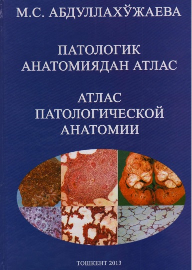 Патологик анатомиядан атлас . Атлас патологическая анатомии