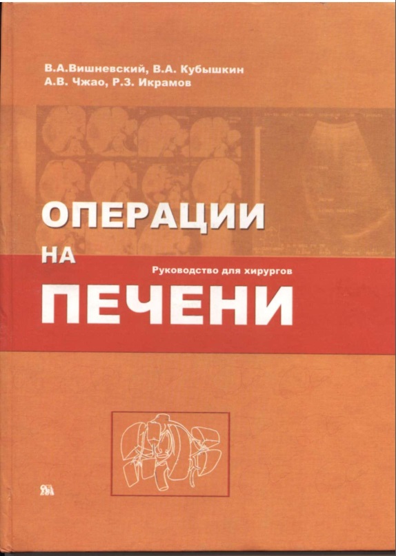 Операции на печени