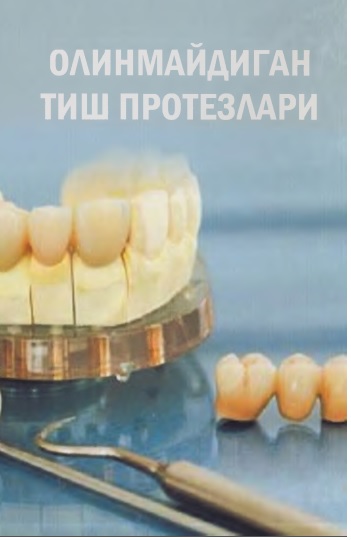 Олинмайдиган тиш протезлари