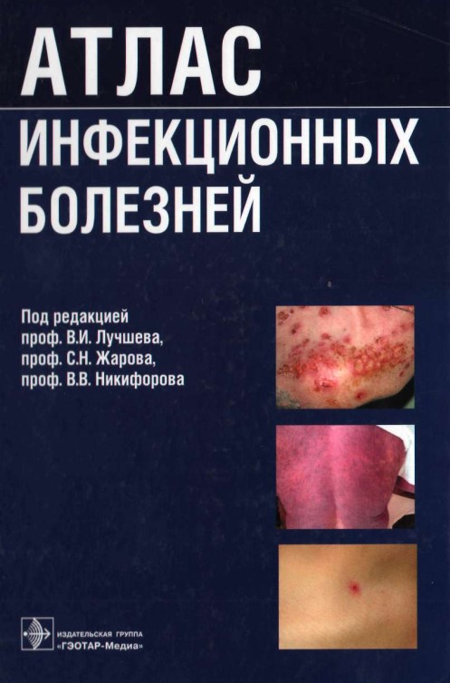 Атлас инфекционных болезней