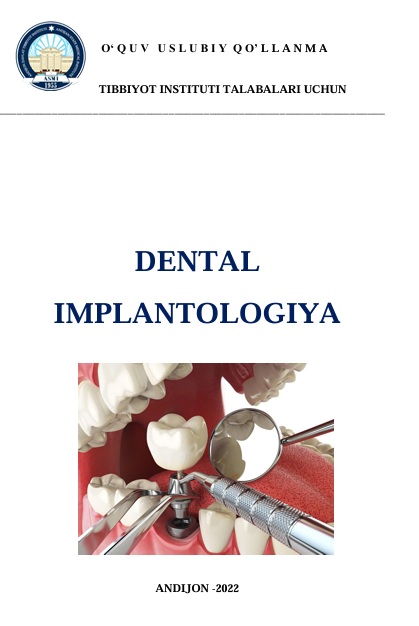 Dental implantologiya