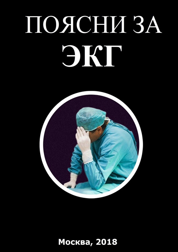 Поясни за ЭКГ