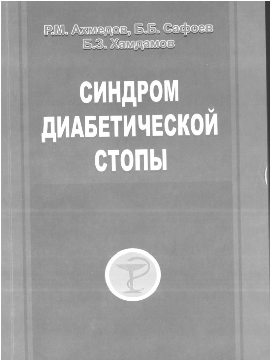 Синдром диабетической стопы