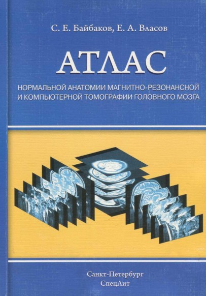 Атлас Нормальной анатомии магнитно- резонансной и компьютерной томографии головного мозга