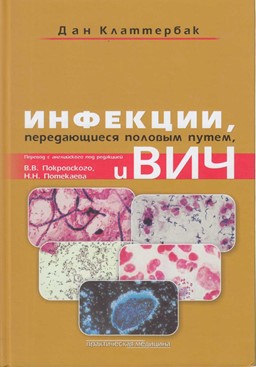 Инфекции передающиеся половым путем, и вич