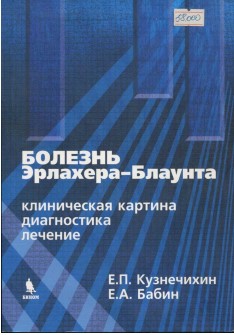 Болезнь эрлахера- блаунта  клиническая картина диагностика лечение
