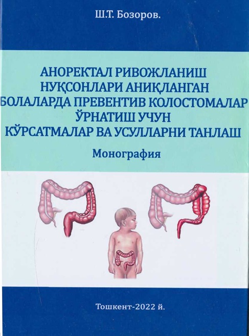 Аноректал ривожланиш нуксонлари аникланган болаларда превентив колостомалар ўрнатиш учун кўрсатмалар ва усулларни танлаш