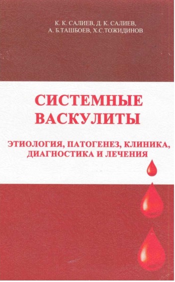 Системные васкулиты