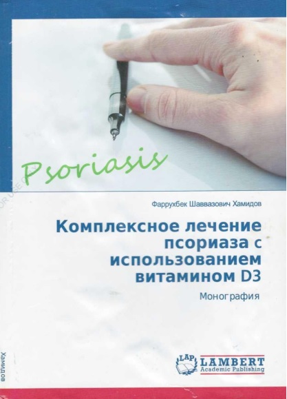 Комплексное лечение псориаза с использованием витамином