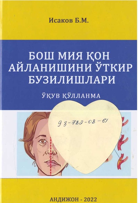 Бош мия кон айланишини ўткир бузилишлари