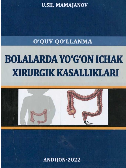 Bolalarda yo'g'on ichak xirurgik kasalliklari