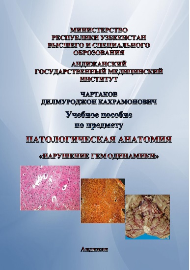 Нарушение гемодинамики