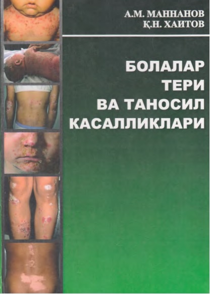 Болаларда тери таносил касалликлари