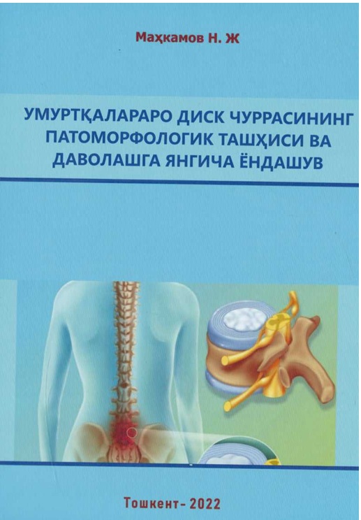 Умурткалараро диск чуррасининг патоморфологик ташхиси ва даволашга янгича ёндашуви