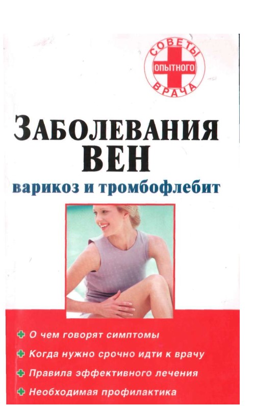 Заболевания вен варикоз и тромбофлебит