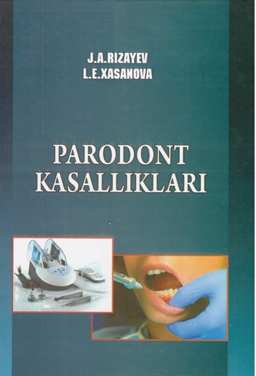 Parodont kasalliklari