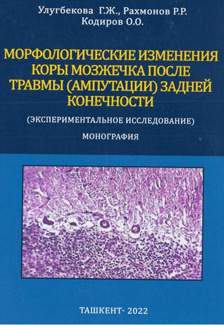 Морфологические изменения коры мозжечка после травмы (ампутации) задней конечности
